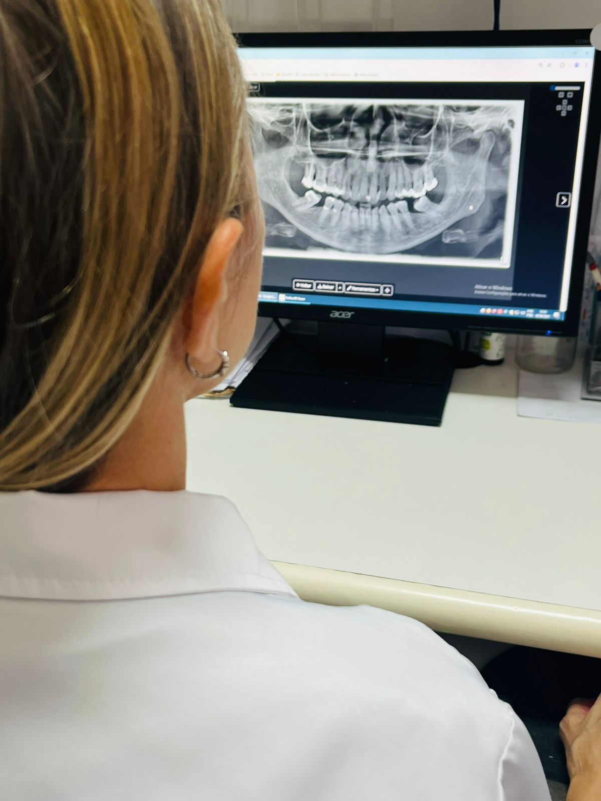 Radiografia Digital